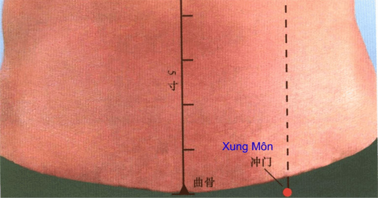 Bấm huyệt Xung Môn là cách chữa rối loạn cương dương hiệu quả, được nhiều nam giới áp dụng