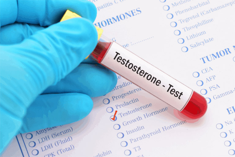 Xét nghiệm đo chỉ số nồng độ nội tiết tố nam testosterone