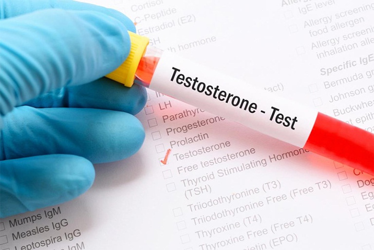 Xét nghiệm nồng độ nội tiết tố testosterone