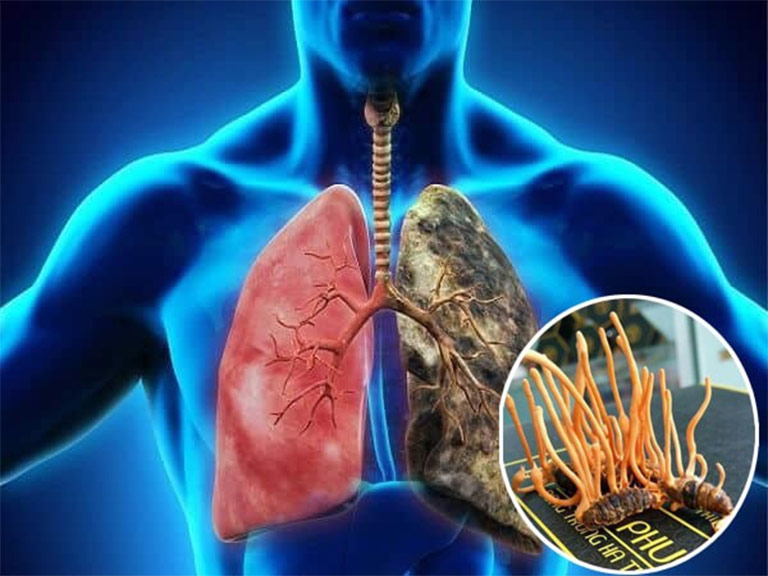 Tác dụng của đông trùng hạ thảo đối với phổi đã được Y học công nhận